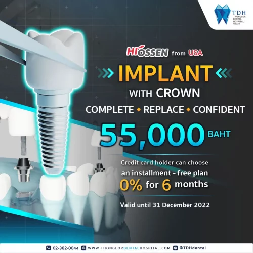 Promotion dental implant