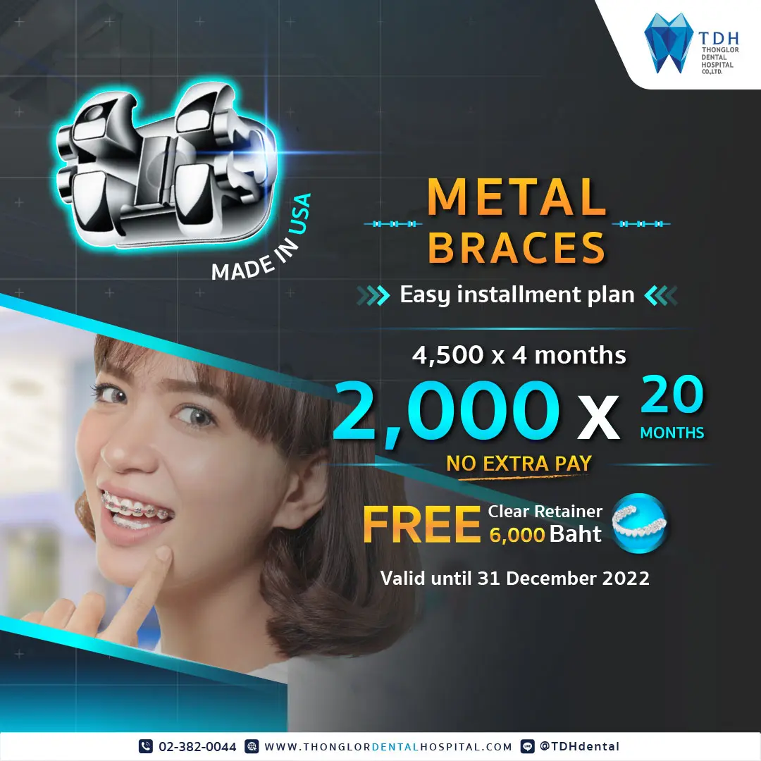 Metal Braces Promotion