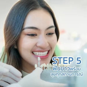 ฟอกฟันขาว ฟอกสีฟัน Zoom White Speed ที่ TDH Dental