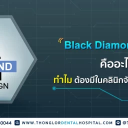 Black Diamond Provider คืออะไร