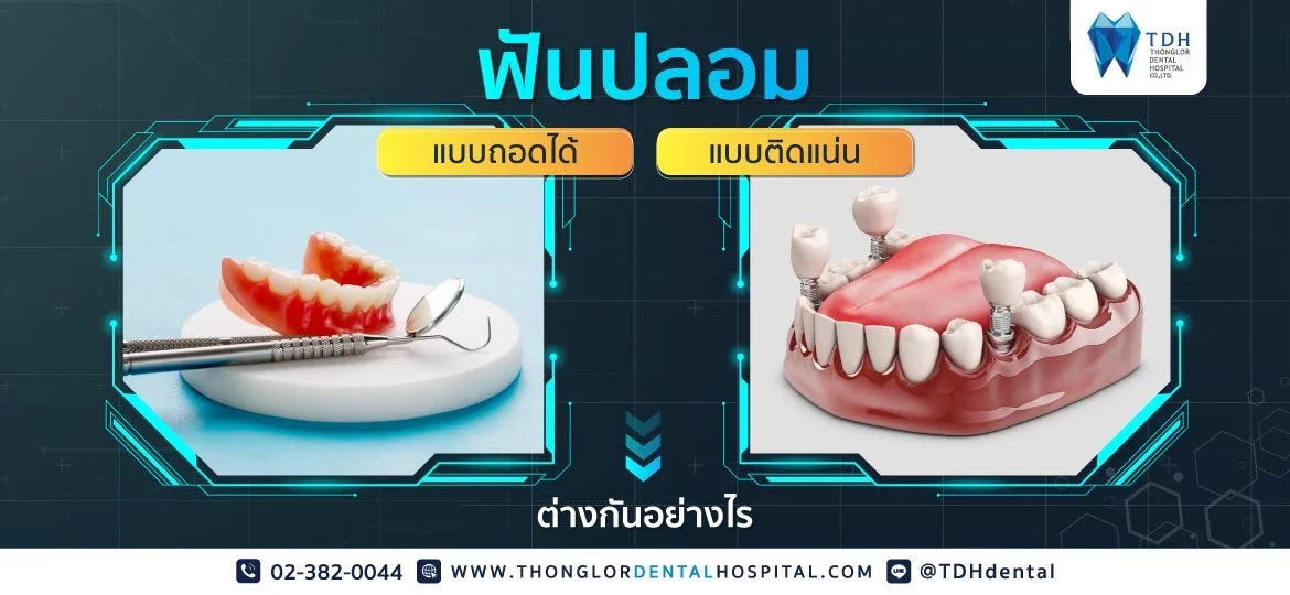 ฟันปลอมแบบติดแน่น ฟันปลอมแบบถอดได้