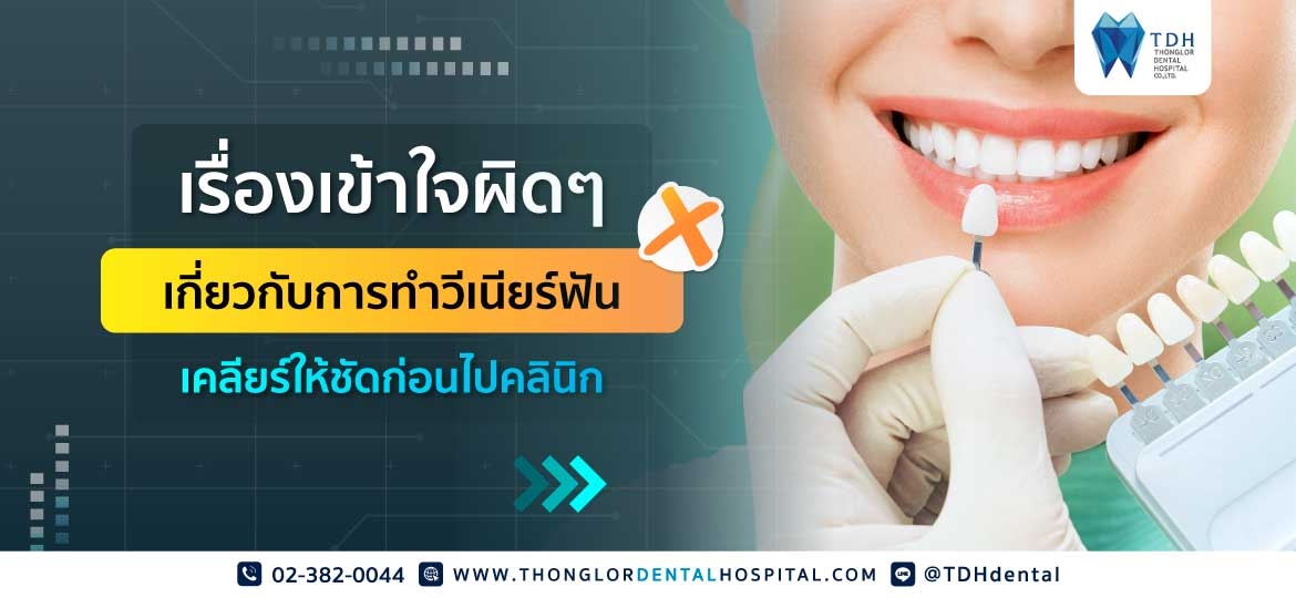 วีเนียร์