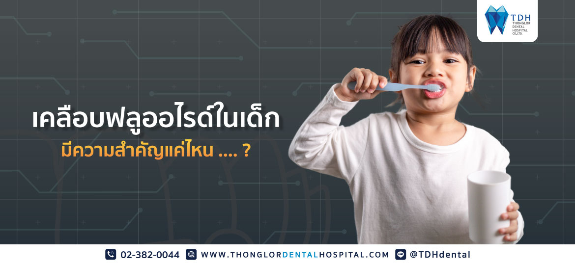 เคลือบฟลูออไรด์