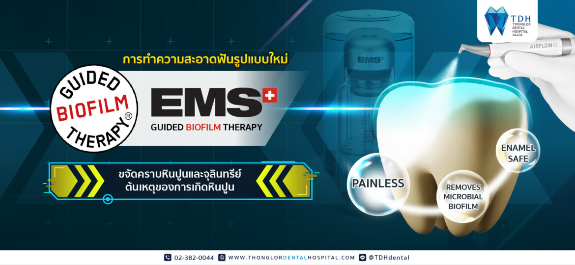 Guided Biofilm Therapy