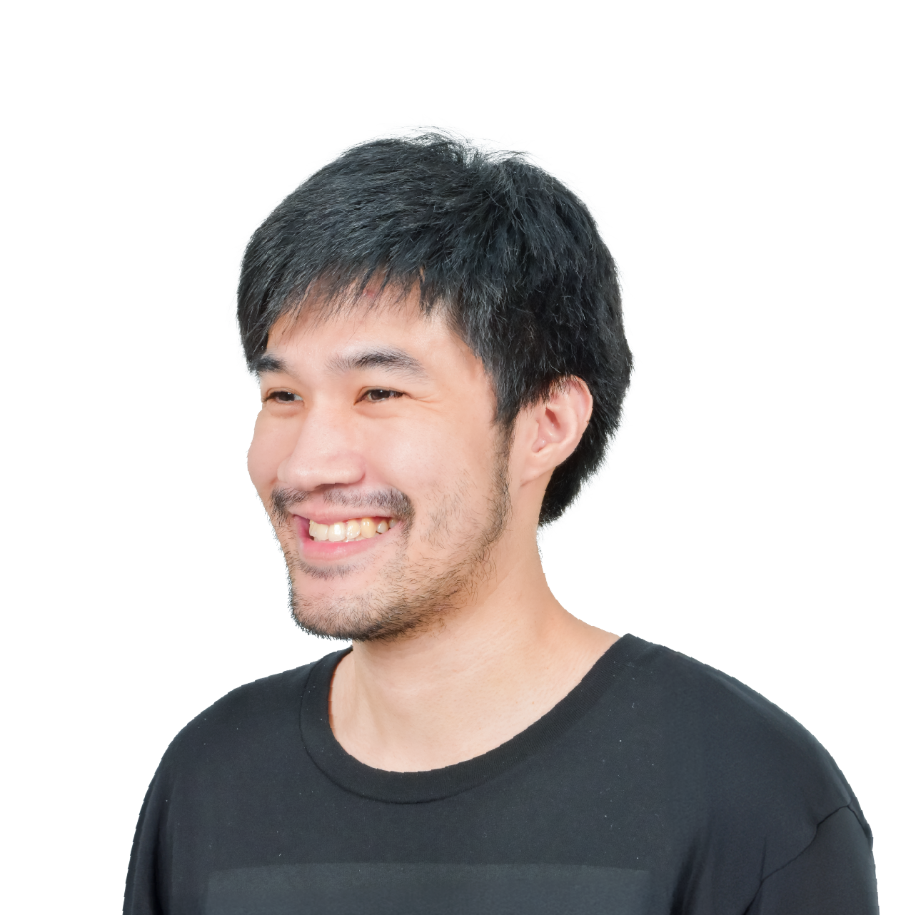 ผ่าตัดขากรรไกร