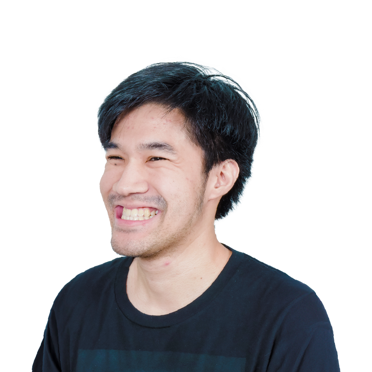 ผ่าตัดขากรรไกร