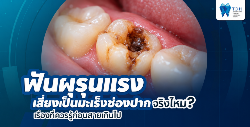 ฟันผุรุนแรงกับมะเร็งช่องปาก ความแตกต่างของโรคฟันผุและสัญญาณเตือนความผิดปกติของเนื้อเยื่อช่องปาก